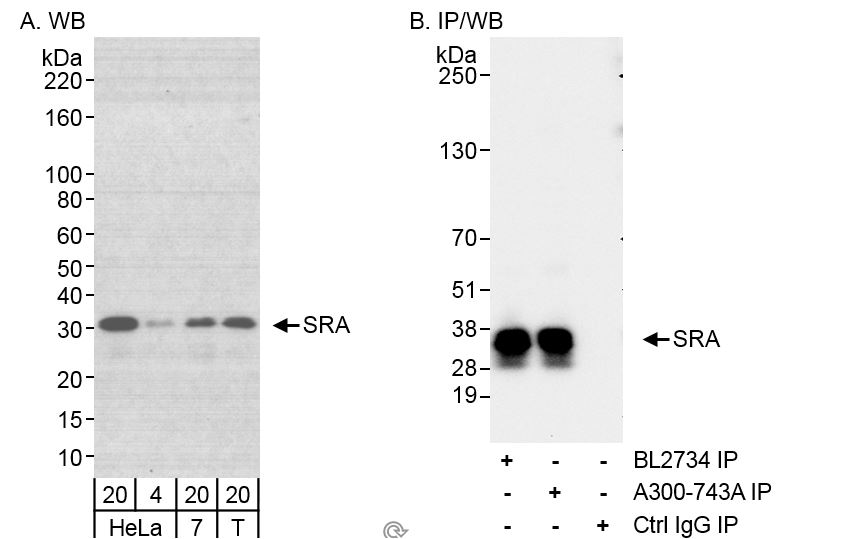 Detection of human SRA by western blot and immunoprecipitation.