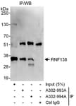 Detection of human RNF138 by western blot of immunoprecipitates.