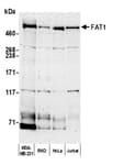 Detection of human FAT1 by western blot.