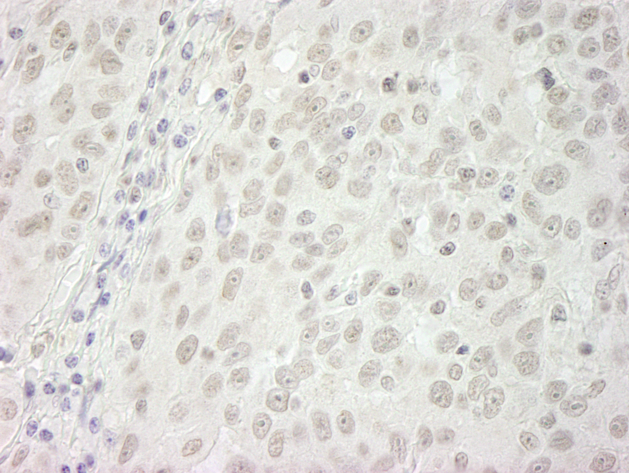 Rabbit anti-BubR1 IHC Antibody