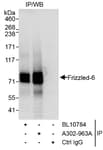 Detection of human Frizzled-6 by western blot of immunoprecipitates.
