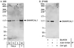 Detection of human SMARCAL1 by western blot and immunoprecipitation.