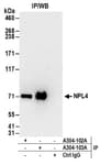 Detection of human NPL4 by western blot of immunoprecipitates.