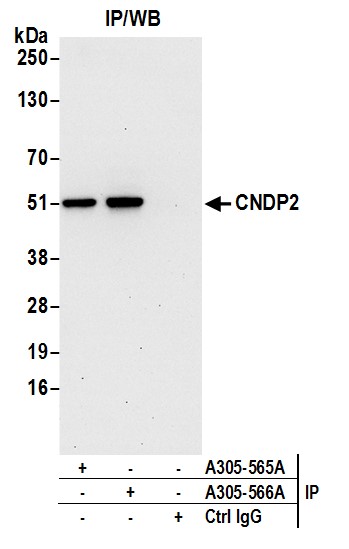 Detection of human CNDP2 by western blot of immunoprecipitates.
