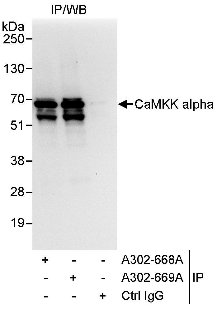 Detection of human CaMKK alpha by western blot of immunoprecipitates.
