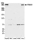 Detection of human FRAS1 by western blot.