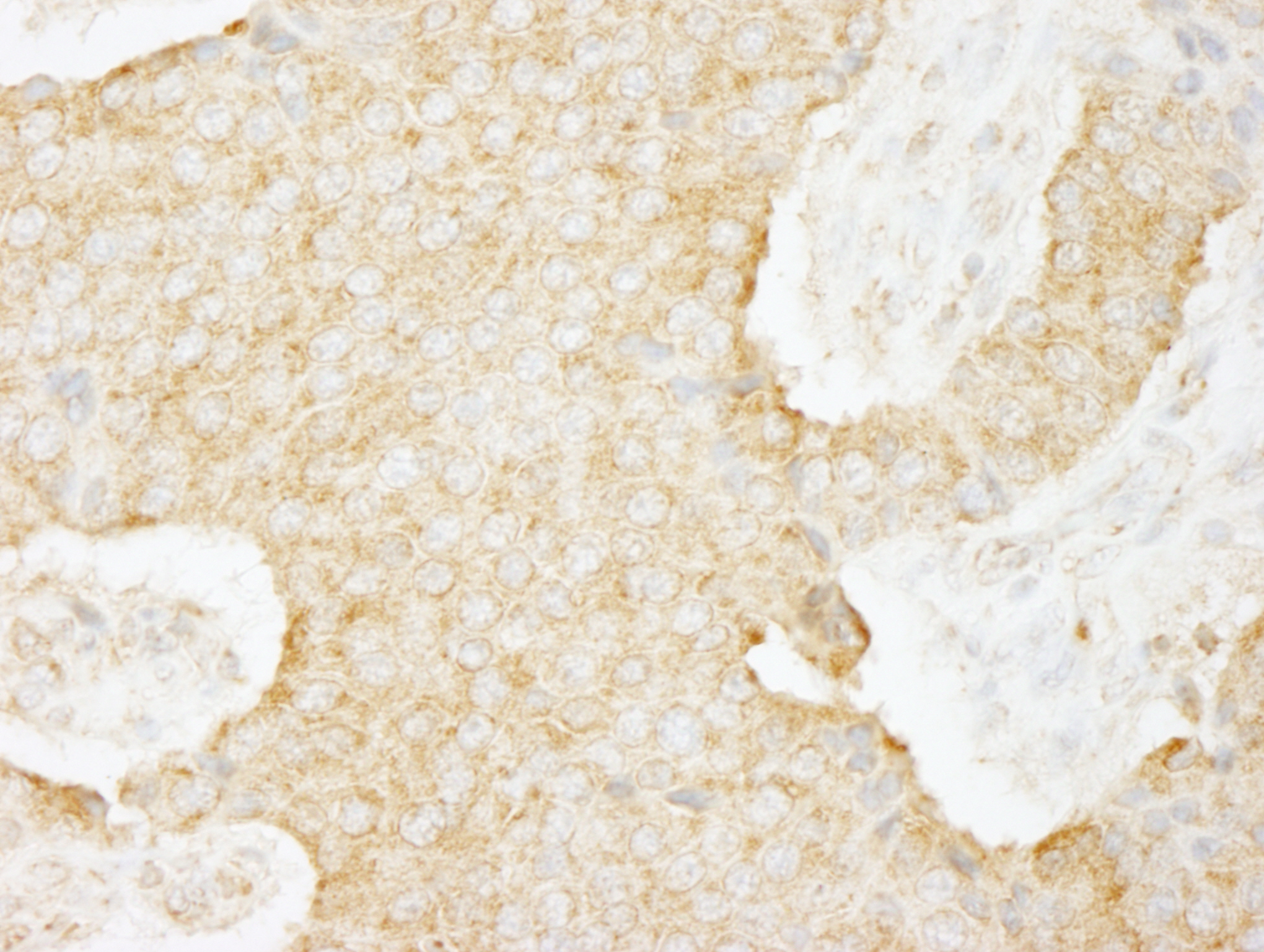 Rabbit anti-USP3 IHC Antibody