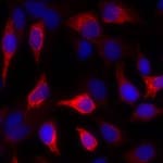 Detection of human Cytokeratin by immunocytochemistry.