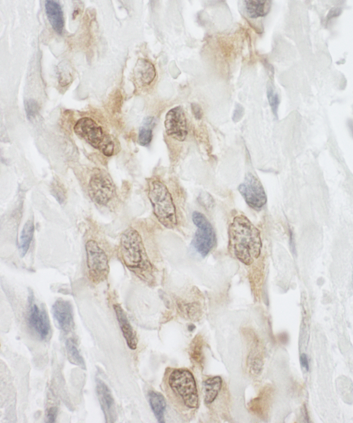 Rabbit anti-LPP IHC Antibody
