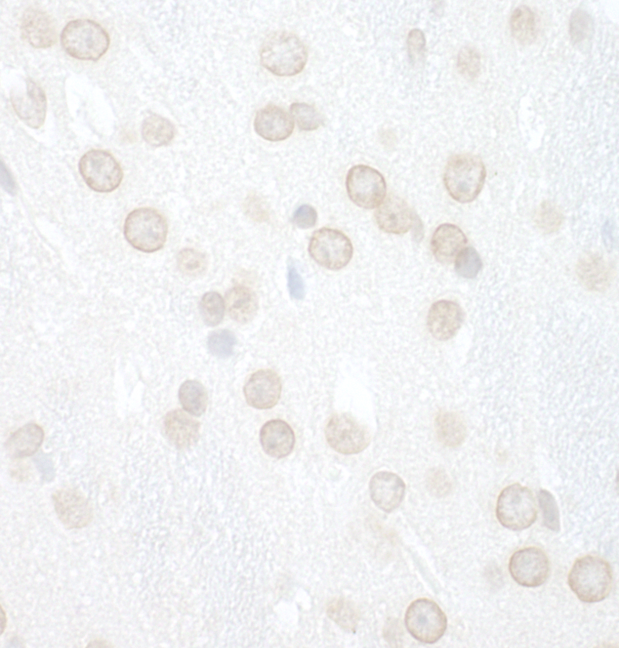 Rabbit anti-WDFY3 IHC Antibody