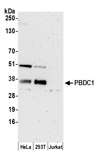 Detection of human PBDC1 by western blot.