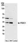 Detection of human PBDC1 by western blot.