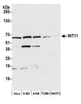 Detection of human and mouse INT11 by western blot.
