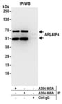 Detection of human ARL6IP4 by western blot of immunoprecipitates.