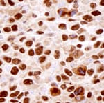 Detection of mouse hnRNP-K by immunohistochemistry.