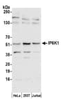 Detection of human IP6K1 by western blot.
