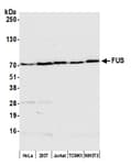 Detection of human and mouse FUS by western blot.