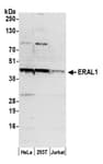 Detection of human ERAL1 by western blot.