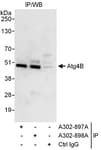 Detection of human Atg4B by western blot of immunoprecipitates.