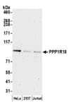 Detection of human PPP1R18 by western blot.