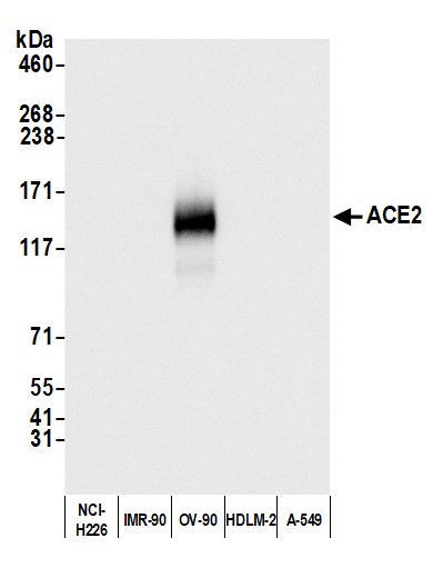 Rabbit anti-ACE2 Antibody Affinity Purified