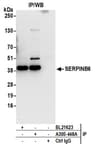 Detection of human SERPINB6 by western blot of immunoprecipitates.
