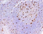 Detection of human CD68 by immunohistochemistry.
