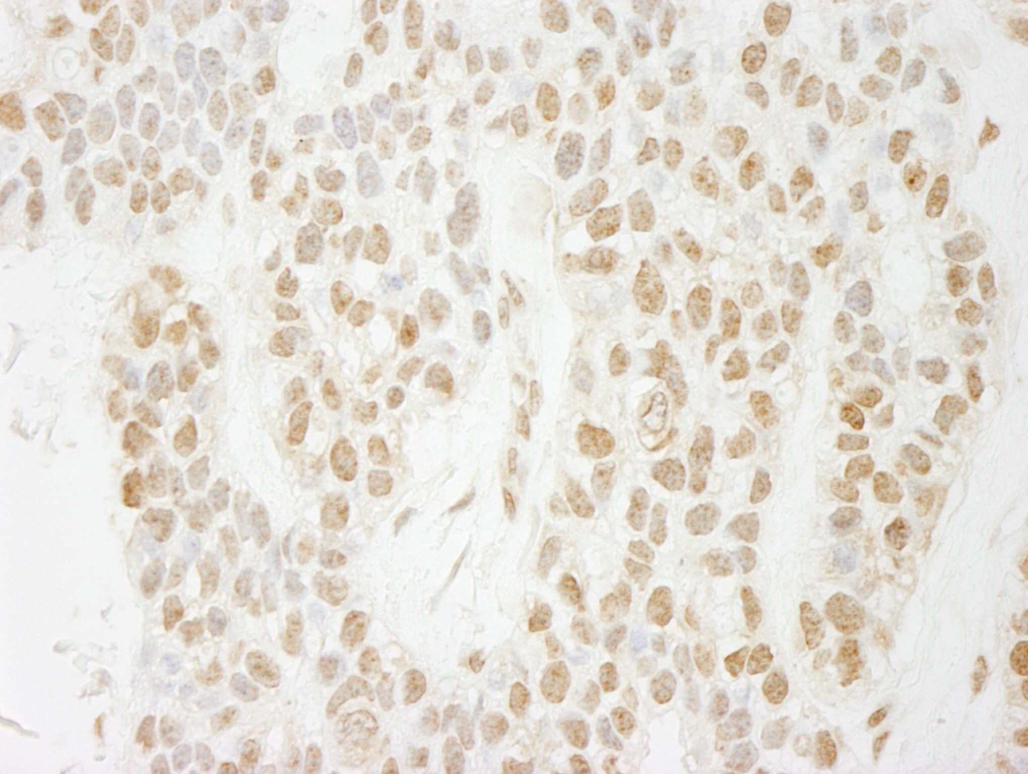 Rabbit anti-PA1 IHC Antibody