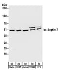 Detection of human and mouse Septin 7 by western blot.