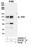 Detection of human ROR1 by western blot of immunoprecipitates.