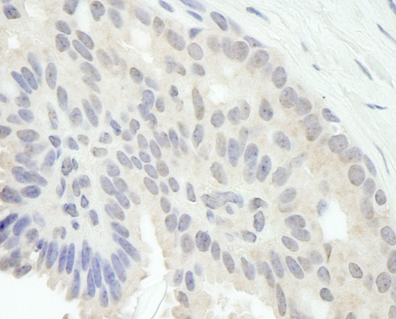 Rabbit anti-E2F1 IHC Antibody