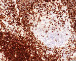 Detection of human CD5 by immunohistochemistry.