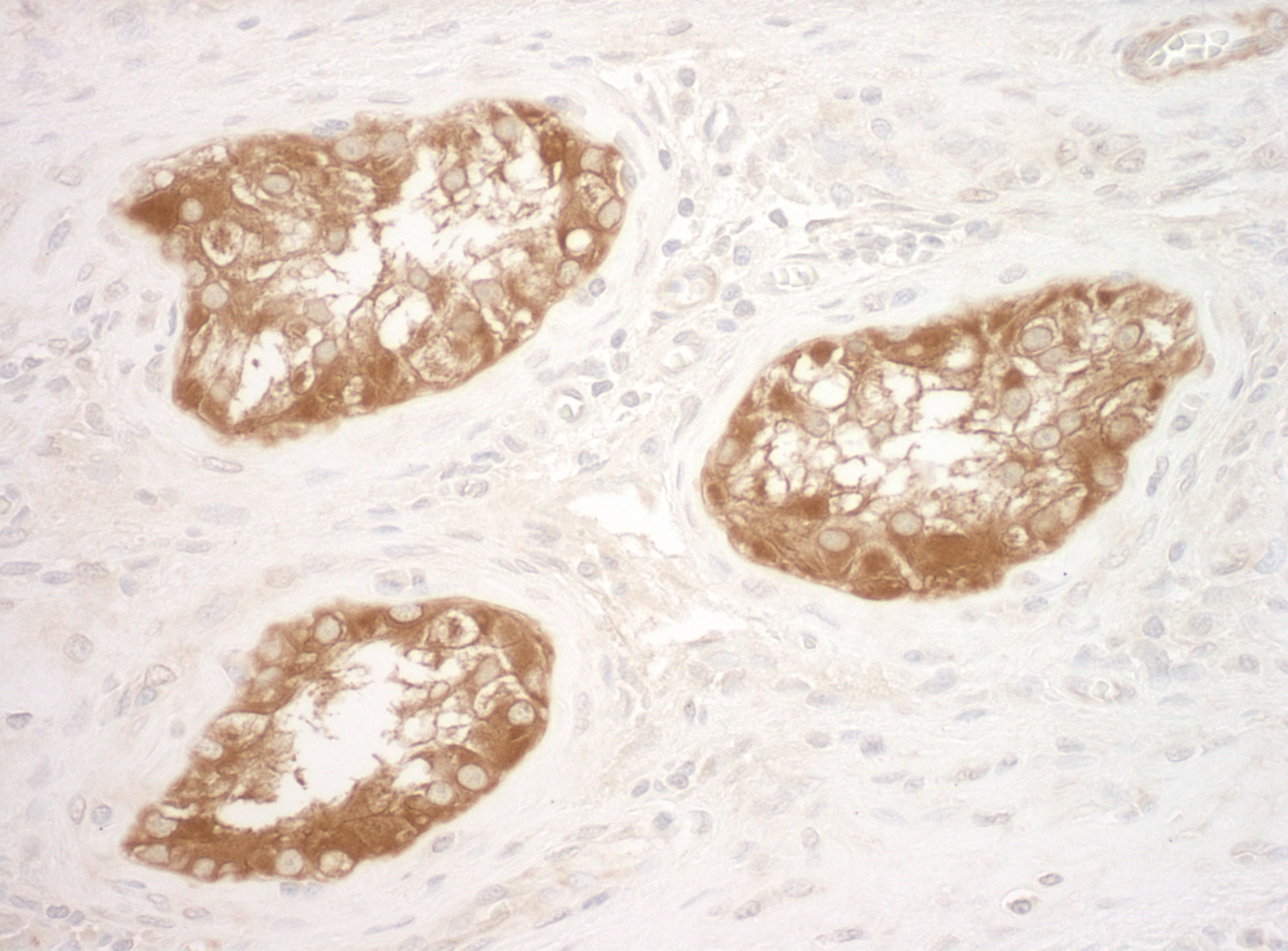 Rabbit anti-Vinculin IHC Antibody