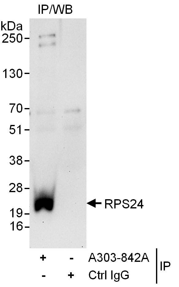 Detection of human RPS24 by western blot of immunoprecipitates.