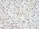 Detection of mouse CCAR1 by immunohistochemistry.
