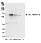 Detection of human and mouse DNA Helicase B by western blot.