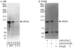 Detection of human SPICE by western blot and immunoprecipitation.