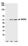 Detection of human SESN2 by western blot.