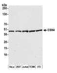 Detection of human and mouse CSN4 by western blot.