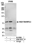 Detection of human HSD17B4/MFE-2 by western blot of immunoprecipitates.