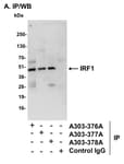 Detection of mouse IRF1 by western blot of immunoprecipitates.