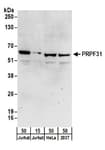Detection of human PRPF31 by western blot.