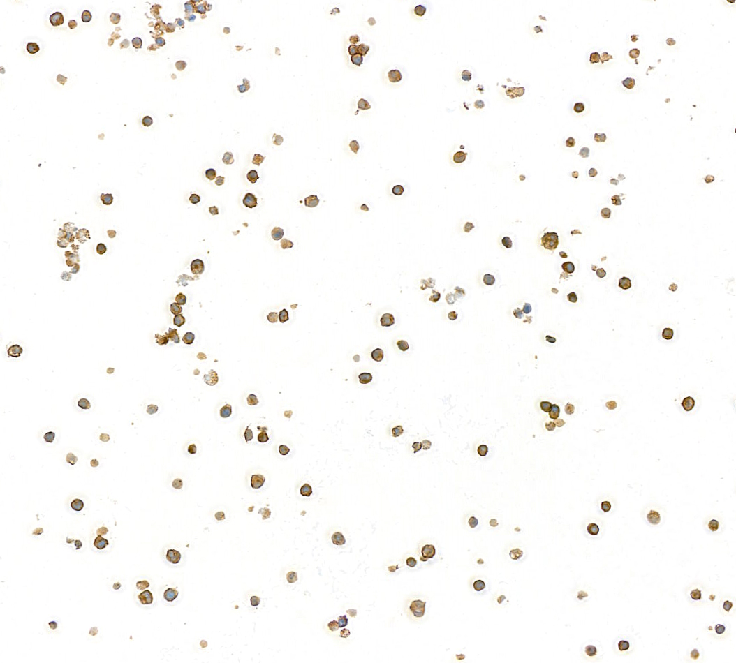 Detection of human CD79B by immunocytochemistry.