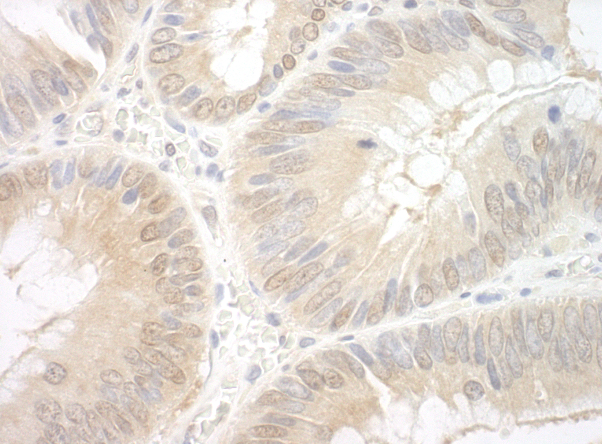 Rabbit anti-EAF2 IHC Antibody
