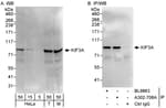 Detection of human and mouse KIF3A by western blot (h&amp;m) and immunoprecipitation (h).