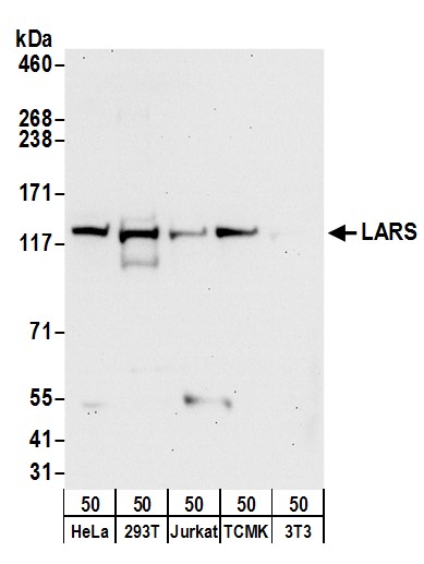 Detection of human and mouse LARS by western blot.