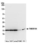 Detection of human and mouse TMEM109 by western blot.