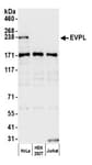 Detection of human EVPL by western blot.
