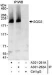 Detection of human SGO2 by western blot of immunoprecipitates.