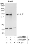 Detection of human AHI1 by western blot of immunoprecipitates.